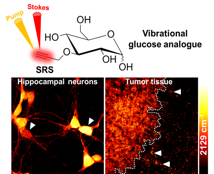 SRS imaging of glucose metabolism