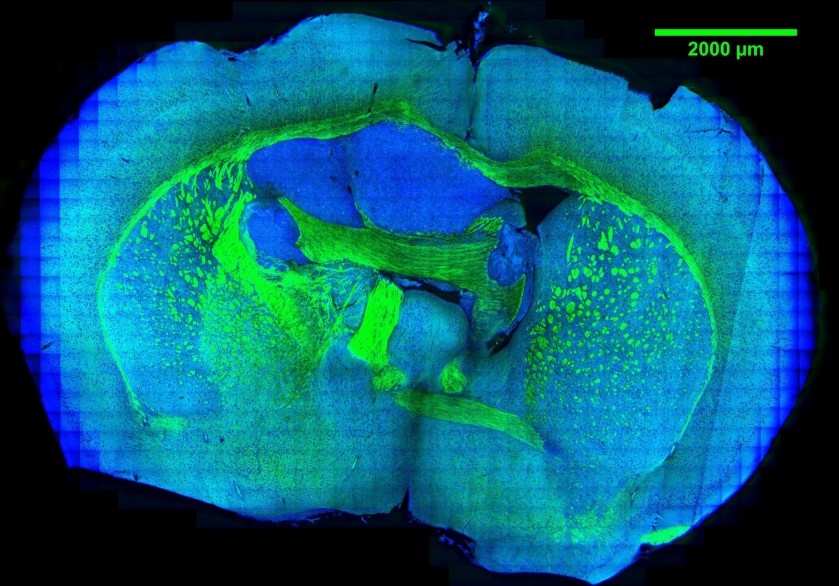 Chemical imaging of cancer metabolism